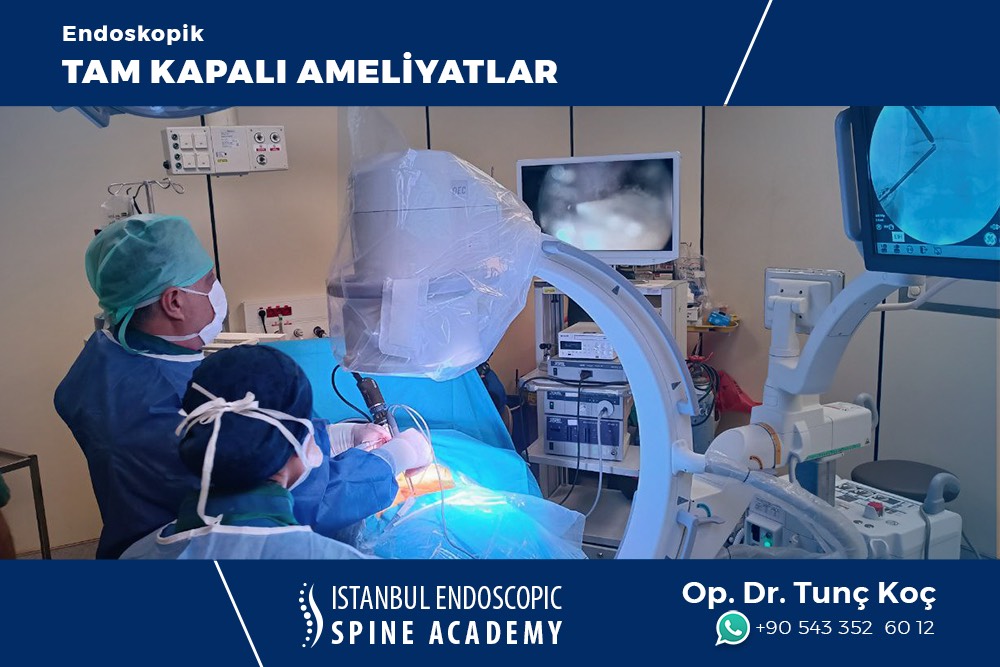 Tam Kapalı Bel Fıtığı Ameliyatı