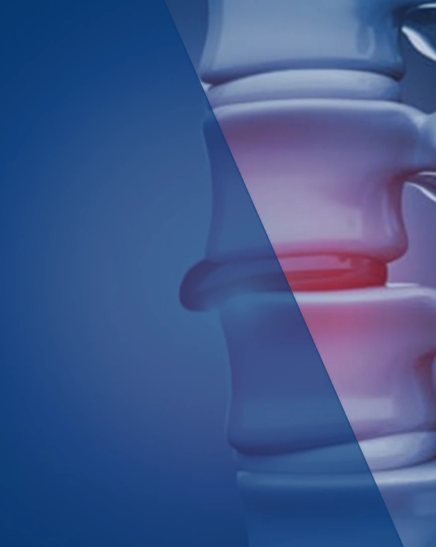 Op. Dr. Tunç Koç - Bel Fıtığı