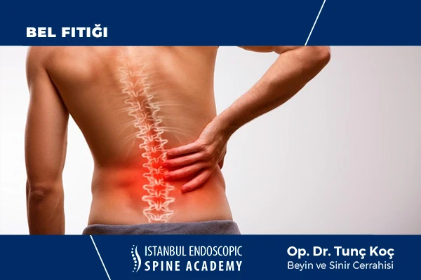 Bel Fıtığı Neden Olur