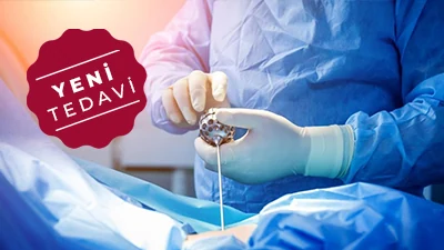 Belde Kök Hücre ve Eksozom Tedavisi