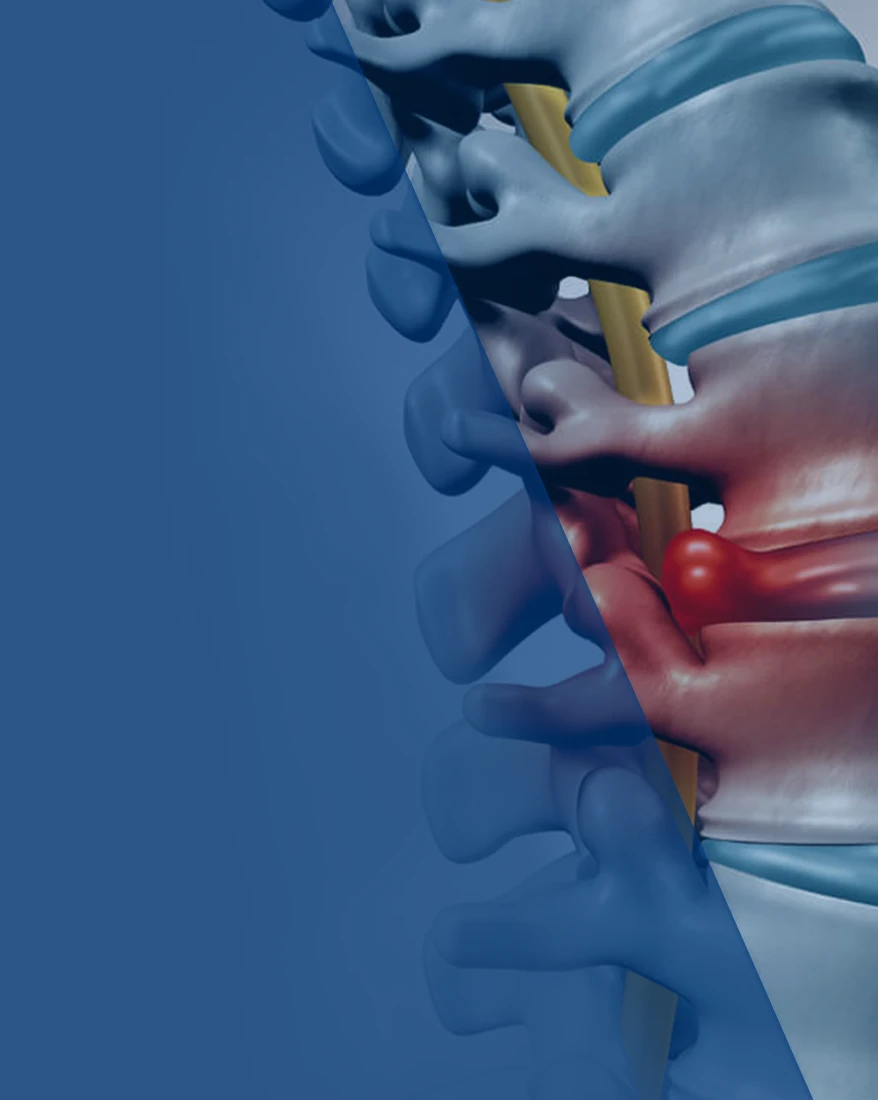 Op. Dr. Tunç Koç - Boyun Fıtığı Tedavisi