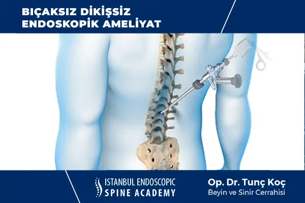 Endoskopik Kapalı Ameliyat