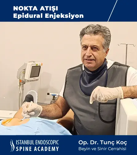 Epidural Enjeksiyon - Nokta Atışı Tedavisi