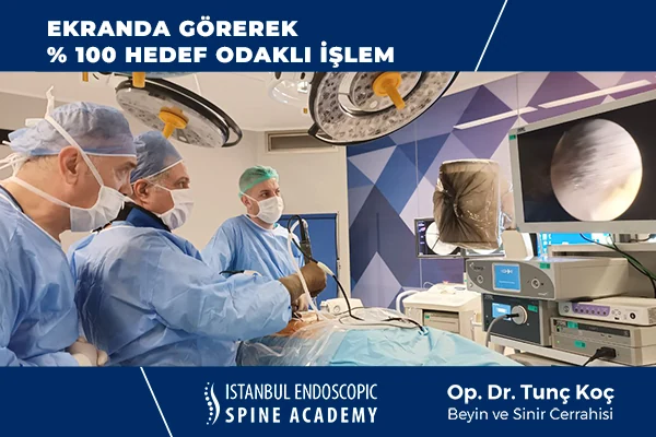 Kameralı Nükleoplasti Güvenlik Protokolü