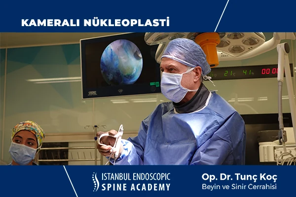 Kameralı Nükleoplasti Nedir
