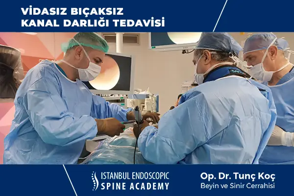 Kapalı Kanal Darlığı Tedavisi