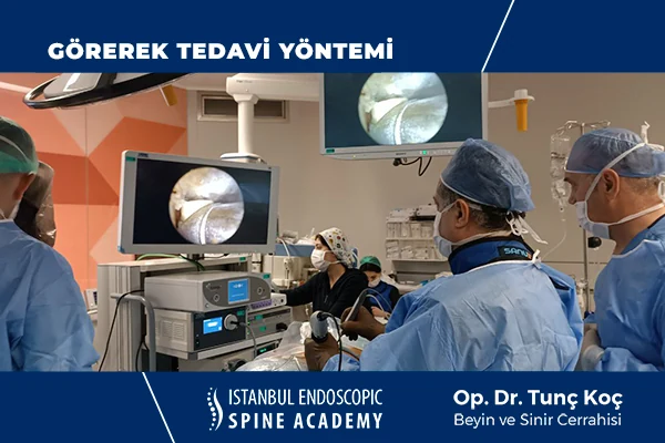 Kireçlenme Tedavisi Görsel Kontrol