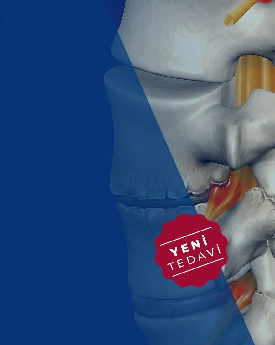 Op. Dr. Tunç Koç - Kameralı Kireçlenme Tedavisi
