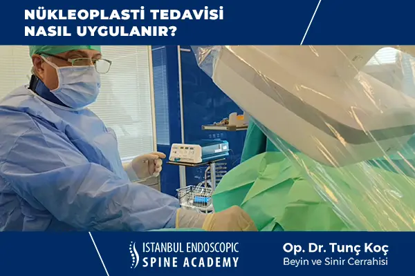 Nükleoplasti Nasıl Uygulanır