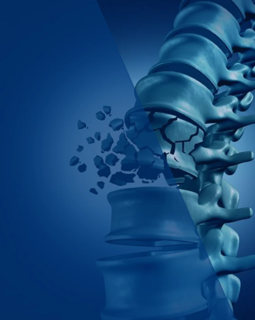 Op. Dr. Tunç Koç - Omurga Kırıkları Tedavisi