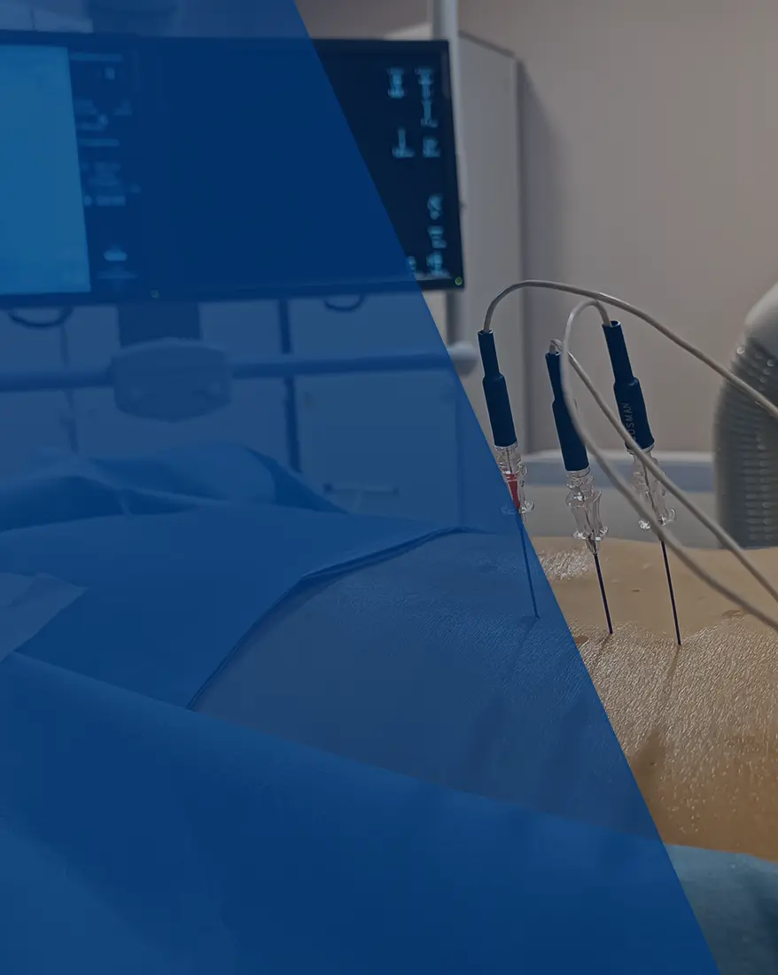 Op. Dr. Tunç Koç - Radyofrekans Tedavisi